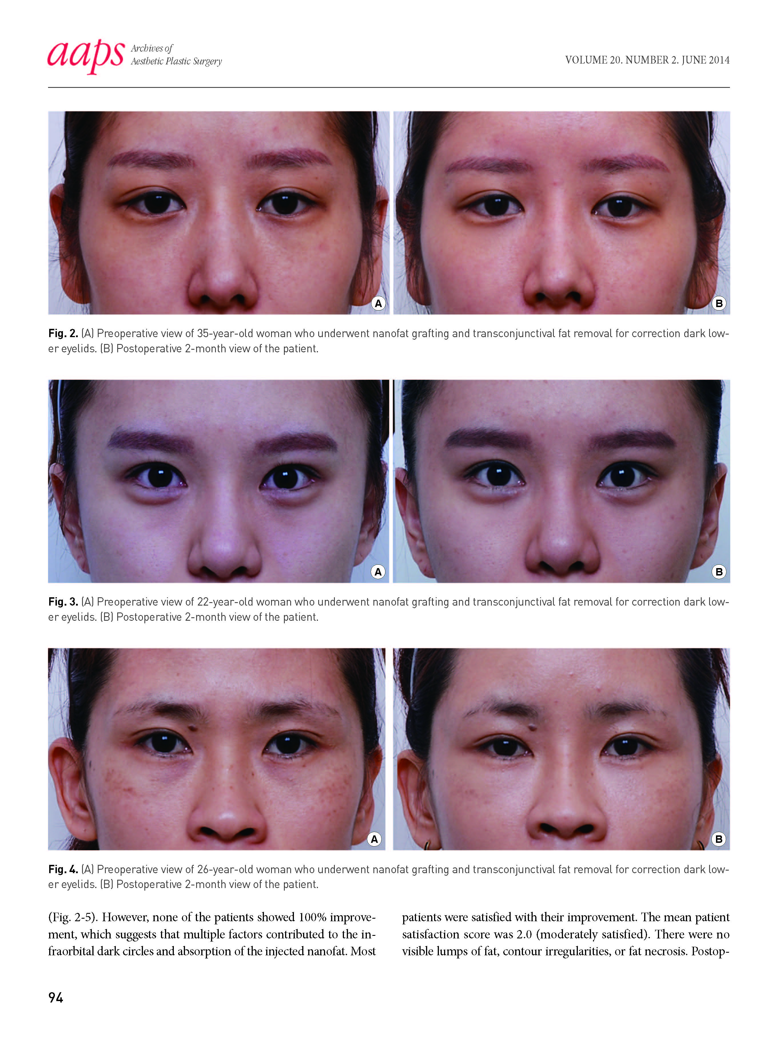 aaps-20-92_페이지_3.jpg